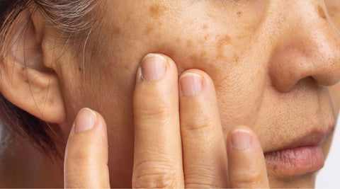 Pigmentation: What Science Really Says